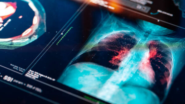 X線画像や超音波画像など約94万名分のデータ流出の可能性【埼玉県健康づくり事業団】